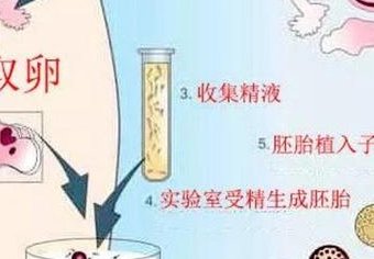 试管移植后要躺着休息吗？其实，看个人身体情况来决定