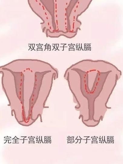 广东省内哪些医院可以做三代试管？专业指南